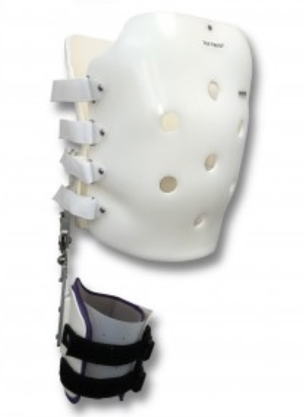 Thoracolumbosacral Orthosis TLSO Cascade Orthotics Calgary